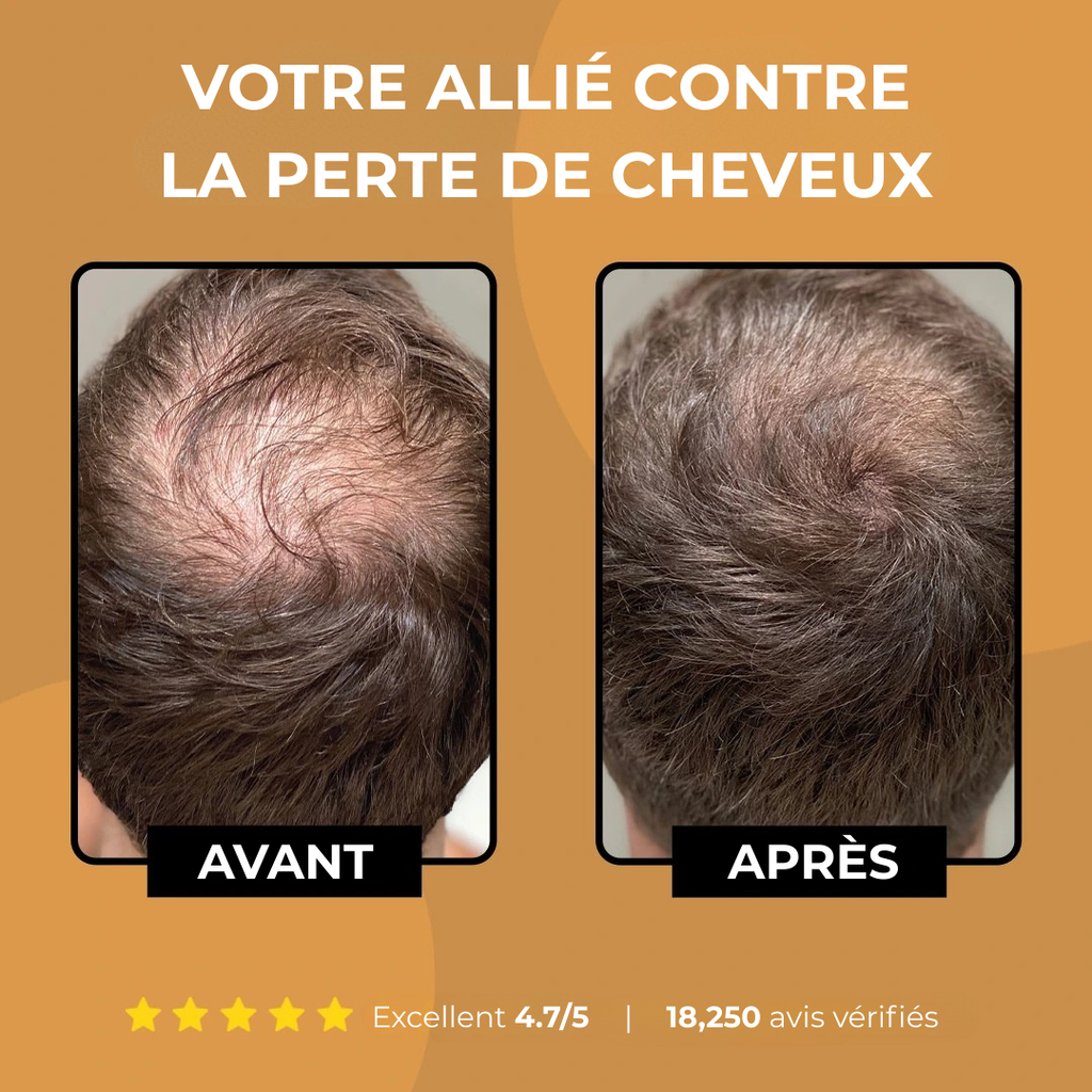 Shampoing Activateur de Racines Spartan — 3 Bouteilles (50% de Réduction Supplémentaire)